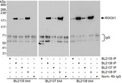 ROCK1 Rabbit anti-Human, Polyclonal, Bethyl Laboratories 100 &mu;L; Unconjugated:Antibodies,
