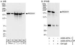 ROCK1 Rabbit anti-Human, Mouse, Polyclonal, Bethyl Laboratories 100 &mu;l;