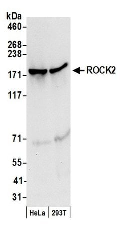 ROCK2 Rabbit anti-Human, Polyclonal, Bethyl Laboratories 100 &mu;L; Unconjugated:Antibodies,