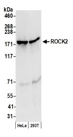 ROCK2 Polyclonal Antibody, Bethyl Laboratories 20 &mu;L; Unconjugated:Antibodies,