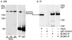 ROCK2 Rabbit anti-Human, Polyclonal, Bethyl Laboratories 100 &mu;L; Unconjugated:Antibodies,