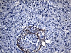 ROR2 Mouse anti-Human, Clone: OTI4B10, liquid, TrueMAB 100 &mu;L; Unconjugated:Antibodies,