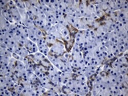 ROR2 Monoclonal Antibody (OTI2G1), TrueMAB , OriGene 100 &mu;L | Buy Online | Origene Technologies | Fisher Scientific