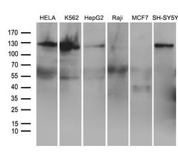 ROR2 Mouse anti-Human, Clone: OTI4B10, liquid, TrueMAB 100 &mu;L; Unconjugated:Antibodies,