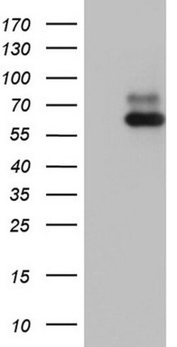 RORA Monoclonal Antibody (OTI2C4), TrueMAB , OriGene 30 &mu;L; Unconjugated:Antibodies,