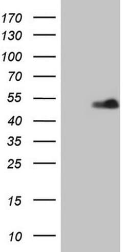 RORB Monoclonal Antibody (OTI1B6), TrueMAB , OriGene 100 &mu;L; Unconjugated:Antibodies,