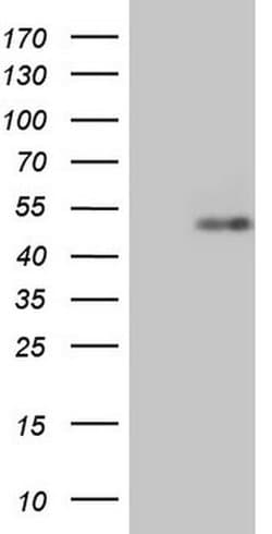 RORB Monoclonal Antibody (OTI4B7), TrueMAB , OriGene:Antibodies:Primary