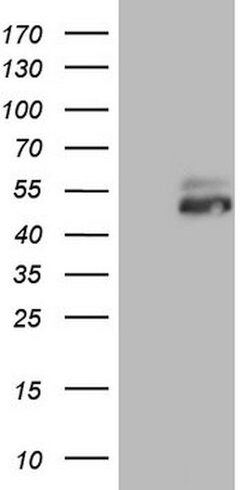 RORB Mouse anti-Human, Clone: OTI1C11, lyophilized, TrueMAB 100 &mu;g;