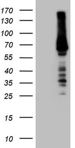 RORC Monoclonal Antibody (OTI3C12), TrueMAB , OriGene:Antibodies:Primary
