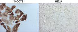 ROS1 Mouse anti-Human, Clone: OTI1A1, lyophilized, TrueMAB 100 &mu;g; Unconjugated:Antibodies,