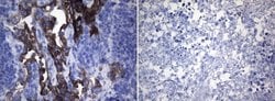 ROS1 Mouse anti-Human, Clone: OTI1A1, lyophilized, TrueMAB 100 &mu;g; Unconjugated:Antibodies,