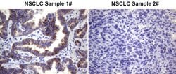 ROS1 Mouse anti-Human, Clone: OTI1A1, lyophilized, TrueMAB 100 &mu;g; Unconjugated:Antibodies,
