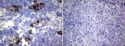 ROS1 Monoclonal Antibody (OTI7E4), TrueMAB , OriGene 100 &mu;L; Unconjugated:Antibodies,