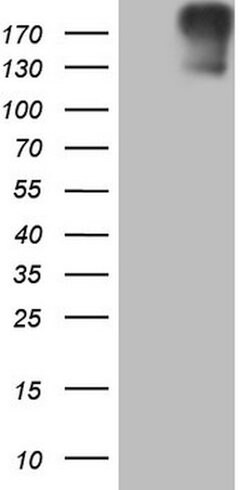 ROS1 Mouse anti-Human, Clone: OTI1A1, lyophilized, TrueMAB 100 &mu;g; Unconjugated:Antibodies,
