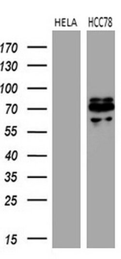ROS1 Mouse anti-Human, Clone: OTI1A1, lyophilized, TrueMAB 100 &mu;g; Unconjugated:Antibodies,