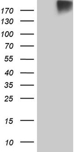 ROS1 Monoclonal Antibody (OTI7E4), TrueMAB , OriGene 100 &mu;L; Unconjugated:Antibodies,