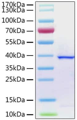 Invitrogen SARS-COV-2 ORF1a Polyprotein (aa1564-1878), His Tag Recombinant