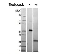 Invitrogen Human VEGF-165, AOF Recombinant Protein 100 &mu;g | Buy Online | Invitrogen&trade; | Fisher Scientific