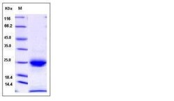 Invitrogen Human Kallikrein 6 His-tag Recombinant Protein 50 &mu;g | Buy Online | Invitrogen&trade; | Fisher Scientific