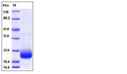 Invitrogen Human LAIR2 Recombinant Protein 100 &mu;g | Buy Online | Invitrogen&trade; | Fisher Scientific