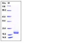 Invitrogen Human LAIR2 Recombinant Protein 10 &mu;g | Buy Online | Invitrogen&trade; | Fisher Scientific