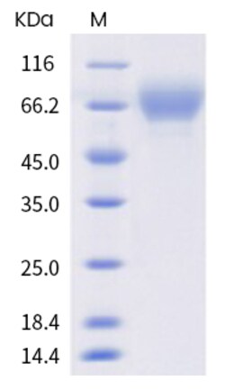 Invitrogen Human LILRA2 (CD85h, ILT1) His-tag Recombinant Protein 1 mg | Buy Online | Invitrogen&trade; | Fisher Scientific