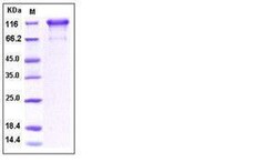 Invitrogen Human PDGFRA (CD140a) Fc Chimera Recombinant Protein 100 &mu;g | Buy Online | Invitrogen&trade; | Fisher Scientific