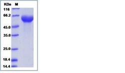 Invitrogen Human ROR1 Recombinant Protein, Biotin 20 &mu;g | Buy Online | Invitrogen&trade; | Fisher Scientific