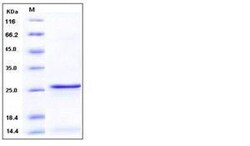 Invitrogen Human S100A9 Recombinant Protein 100 &mu;g | Buy Online | Invitrogen&trade; | Fisher Scientific