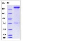 Invitrogen Human P-selectin (CD62P) Fc Chimera Recombinant Protein 100 &mu;g | Buy Online | Invitrogen&trade; | Fisher Scientific