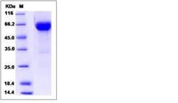 Invitrogen Human VSIG4 Fc Chimera Recombinant Protein 100 &mu;g | Buy Online | Invitrogen&trade; | Fisher Scientific