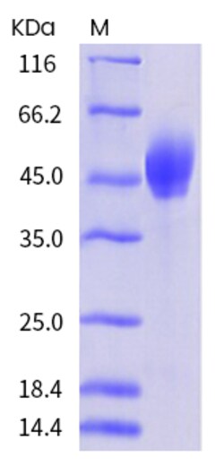Invitrogen Mouse PD-L1 (B7-H1) His-tag Recombinant Protein 1 mg | Buy Online | Invitrogen&trade; | Fisher Scientific
