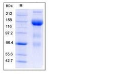 Invitrogen Mouse VEGFR3 (Flt-4) Fc Chimera Recombinant Protein 100 &mu;g | Buy Online | Invitrogen&trade; | Fisher Scientific
