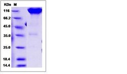Invitrogen Rat PDGFRA (CD140a) Fc Chimera Recombinant Protein 100 &mu;g | Buy Online | Invitrogen&trade; | Fisher Scientific