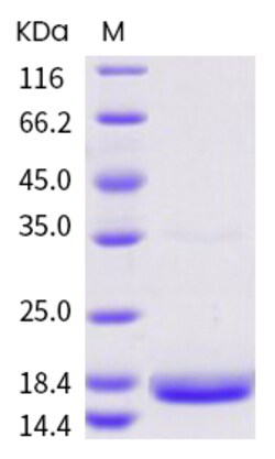 Invitrogen SARS-CoV-2 NSP10 Recombinant Protein 100 &mu;g | Buy Online | Invitrogen&trade; | Fisher Scientific