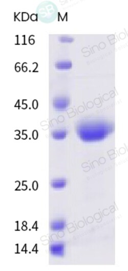 Invitrogen SARS-CoV-2 Spike Protein (RBD) Recombinant Protein 100 &mu;g | Buy Online | Invitrogen&trade; | Fisher Scientific