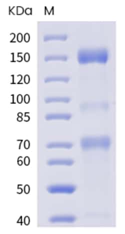 Invitrogen SARS-CoV-2 Spike Protein S1/S2 His-tag Recombinant Protein 100 &mu;g | Buy Online | Invitrogen&trade; | Fisher Scientific