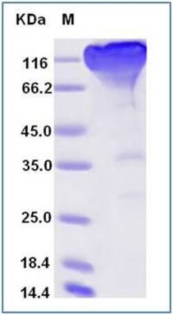 Invitrogen SARS-CoV-2 Spike Protein S1 Fc Chimera Recombinant Protein 100 &mu;g | Buy Online | Invitrogen&trade; | Fisher Scientific
