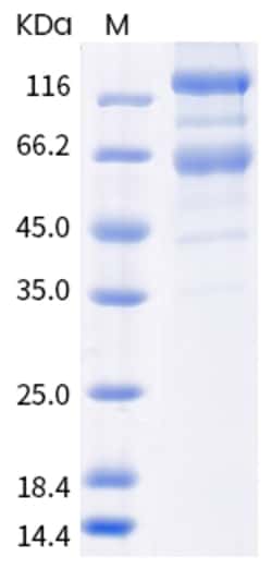 Invitrogen SARS-CoV-2 Spike Protein S1/S2 (B.1.351) His-tag Recombinant Protein 100 &mu;g | Buy Online | Invitrogen&trade; | Fisher Scientific