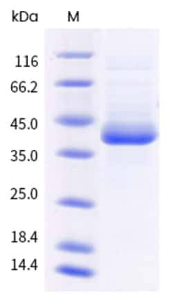 Invitrogen Monkeypox Virus B6R His-tag Recombinant Protein 100 &mu;g | Buy Online | Invitrogen&trade; | Fisher Scientific
