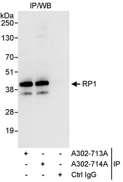 RP1 Rabbit anti-Human, Polyclonal, Bethyl Laboratories 100 &mu;L; Unconjugated:Antibodies,