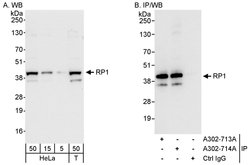 RP1 Rabbit anti-Human, Polyclonal, Bethyl Laboratories 100 &mu;L; Unconjugated:Antibodies,