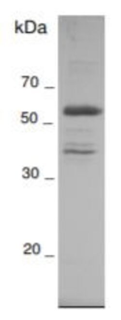 Invitrogen Human HTRA1, Recombinant Protein 5 &mu;g | Buy Online | Invitrogen&trade; | Fisher Scientific