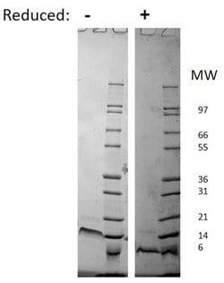 Invitrogen Human CXCL12 (SDF-1a) Recombinant Protein 10 &mu;g | Buy Online | Invitrogen&trade; | Fisher Scientific