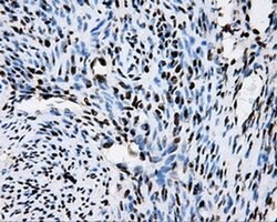 RPA2 Mouse anti-Human, Clone: OTI9A1, liquid, TrueMAB 100 &mu;L; Unconjugated:Antibodies,