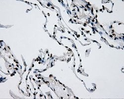 RPA2 Mouse anti-Human, Clone: OTI9A1, liquid, TrueMAB 100 &mu;L; Unconjugated:Antibodies,