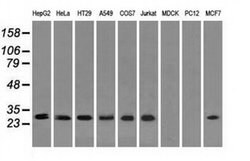 RPA2 Mouse anti-Human, Clone: OTI9A1, liquid, TrueMAB 100 &mu;L; Unconjugated:Antibodies,