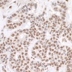 RPA32 Rabbit anti-Human, Mouse, Polyclonal, Bethyl Laboratories 100 &mu;L;
