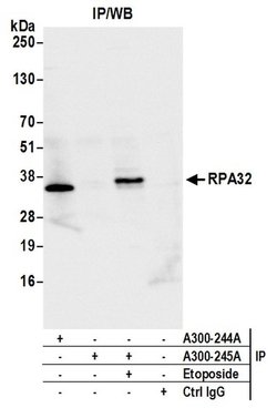 RPA32 Rabbit anti-Human, Mouse, Polyclonal, Bethyl Laboratories 100 &mu;L;