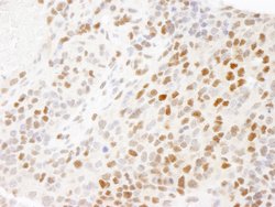 RPA32 Polyclonal Antibody, Bethyl Laboratories 10 &mu;L | Buy Online | Bethyl Laboratories, Inc | Fisher Scientific